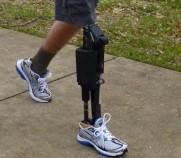prosthetic robotic joints