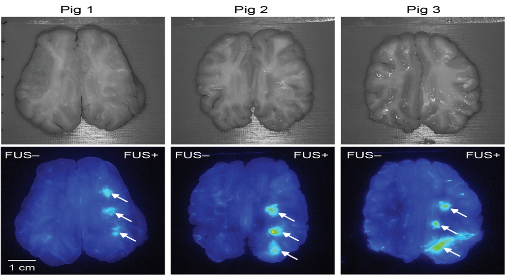 image of pig brain slides with and without ultrasound and drug delivery