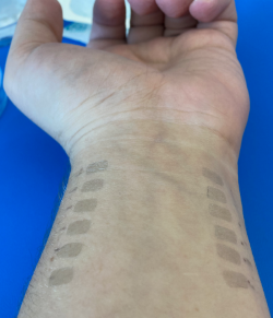 graphene tattoos applied on the underside of the wrist