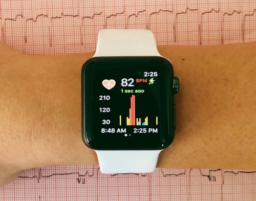smart watch monitoring heart function