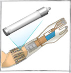 Implantable Sensors for Prosthesis Control